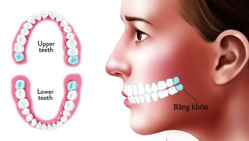 Sức khỏe răng miệng những triệu chứng cần phải quan tâm